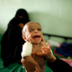 A doctor holds a malnourished boy as his mother sits at a therapeutic feeding centre in the southern Yemeni city of Taiz June 30, 2012. (Reuters /Khaled Abdullah)